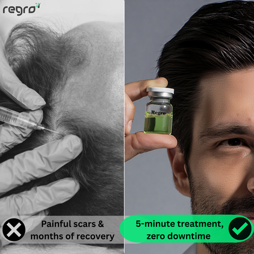 Regro™ Hair Regrowth Kit
